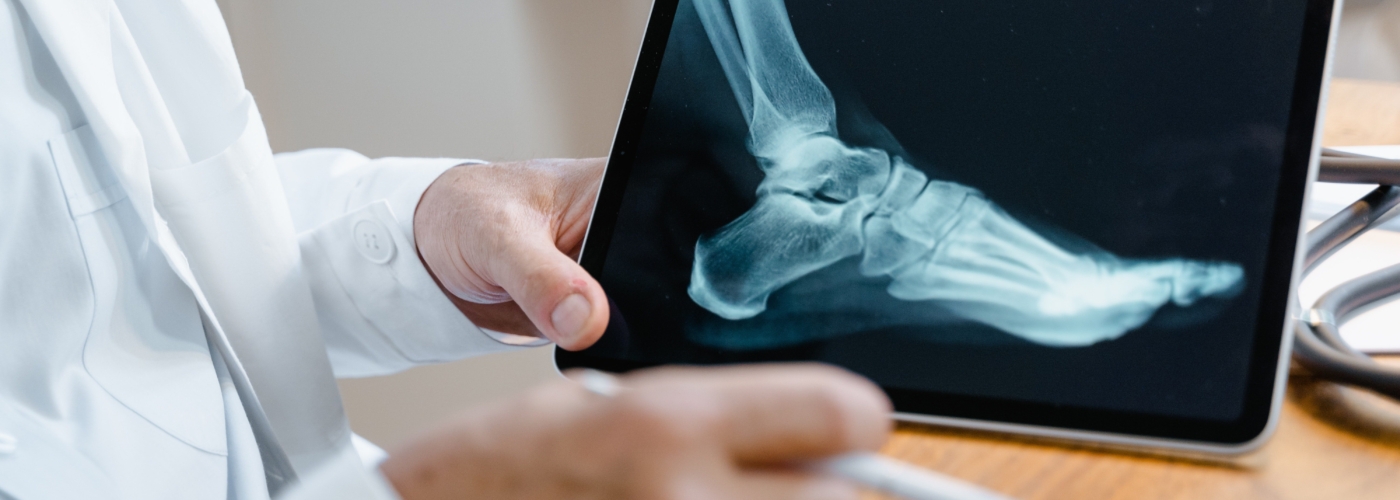 Titelbild zu Secur-e-Health – Smart Fracture Care